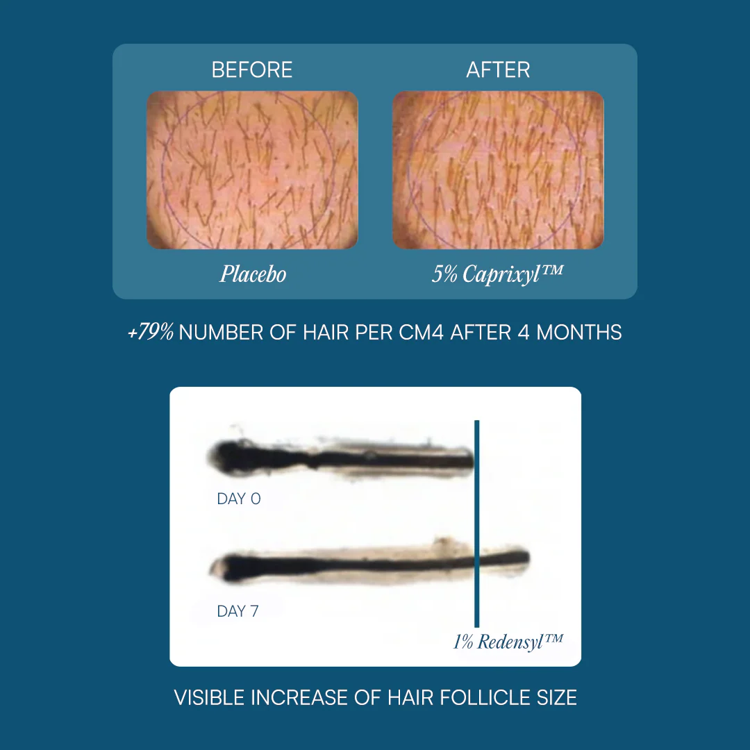The Treatment Scalp Serum - Image 5